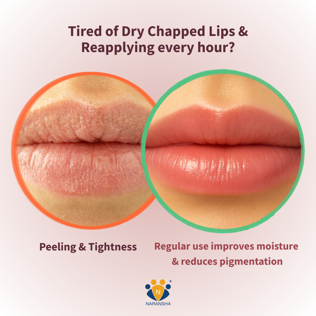 Dark Lips in India: Causes, Myths + Herbal Fixes That Work
