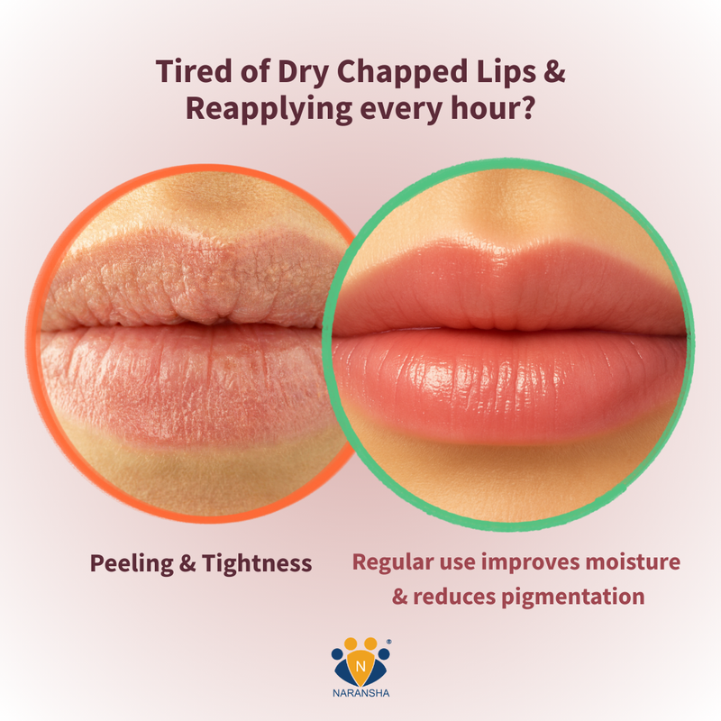 Dark Lips in India: Causes, Myths + Herbal Fixes That Work
