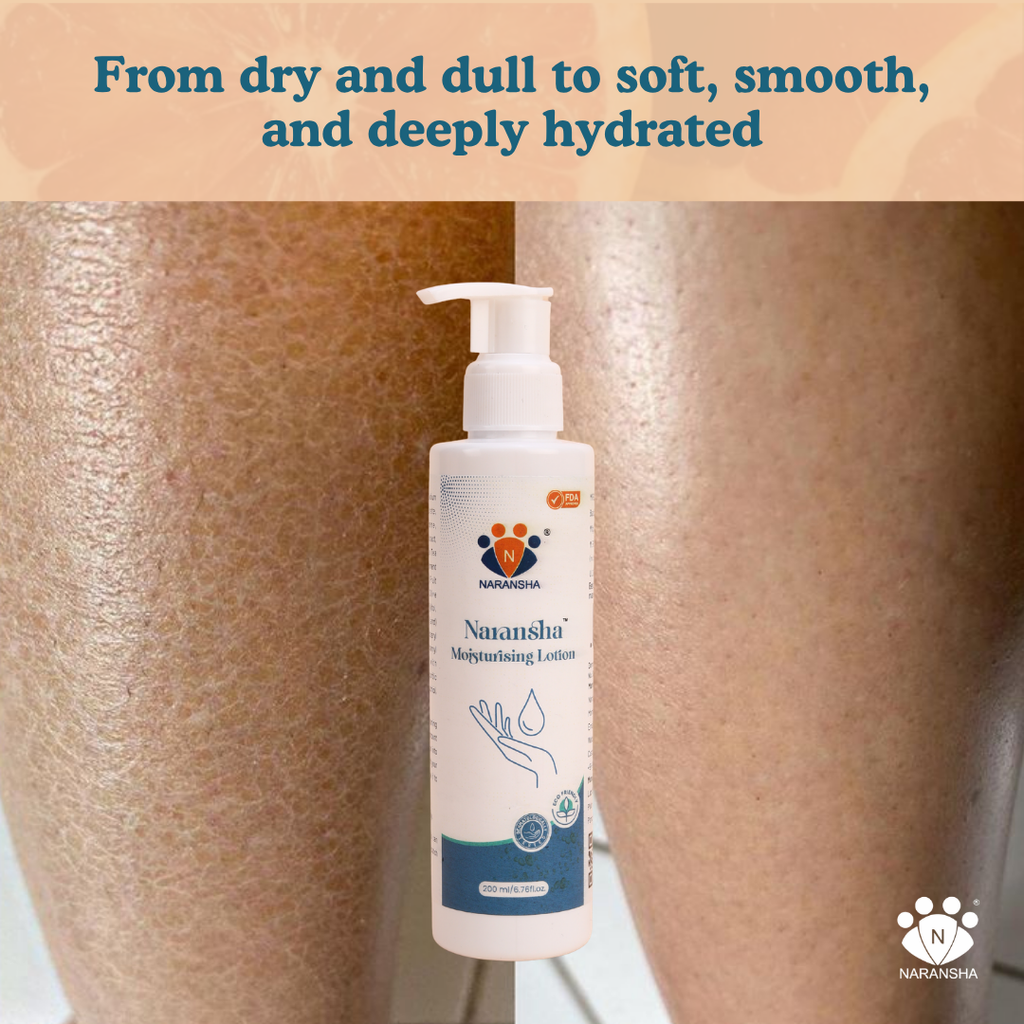 Herbal Body Lotion/ Moisturizer with Niacinamide & Green Tea (200 ml)