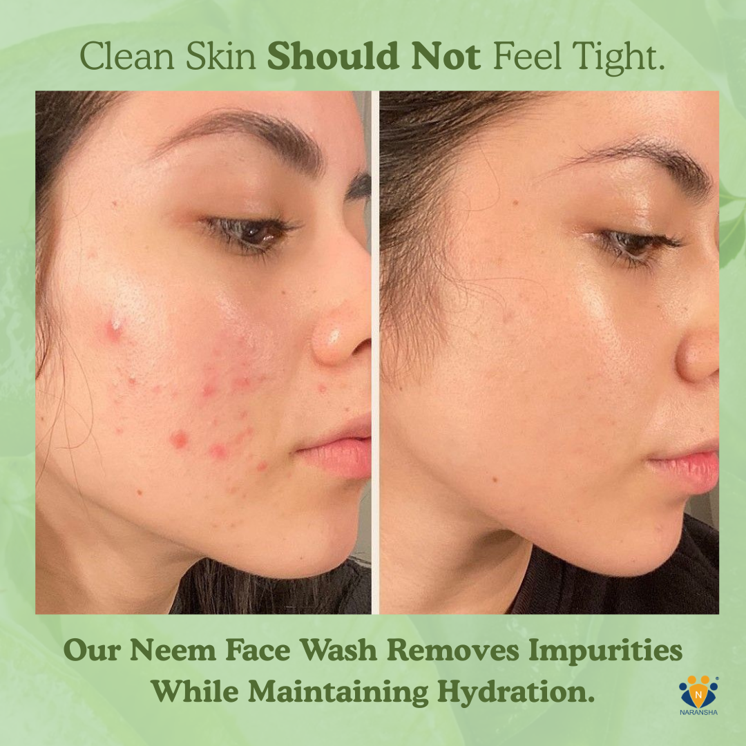 Neem Face Wash with Vitamin E & Hyaluronic Acid for Acne Control (50 ml)