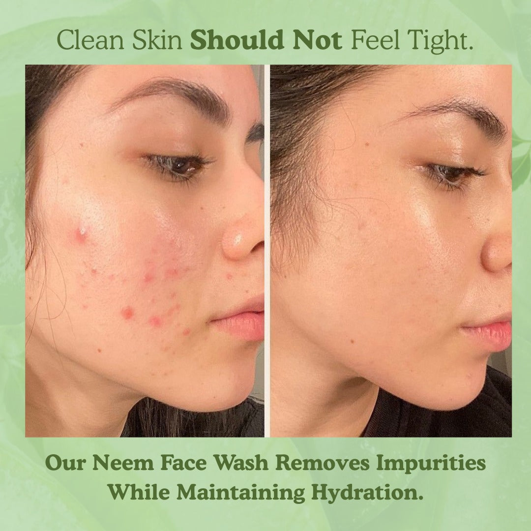 Neem Face Wash with Vitamin E & Hyaluronic Acid for Acne Control (50 ml)